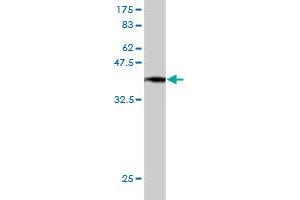 Western Blot detection against Immunogen (37. (LI Cadherin antibody  (AA 24-131))