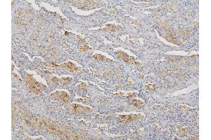 IHC analysis of RNF123 using anti-RNF123 antibody (ABIN6719387). (RNF123 antibody  (AA 12-188))