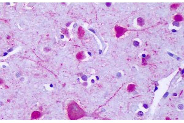 GPR75 antibody  (C-Term)