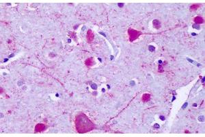 Anti-GPR75 antibody IHC staining of human brain, cortex, neurons.