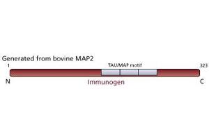 Image no. 2 for anti-Microtubule-Associated Protein 2 (MAP2) antibody (ABIN967494) (MAP2 antibody)