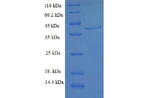 SDS-PAGE (SDS) image for Dual Specificity Phosphatase 13 (DUSP13) (AA 1-198), (full length) protein (His-SUMO Tag) (ABIN5711425) (DUSP13 Protein (AA 1-198, full length) (His-SUMO Tag))