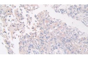 Immunohistochemistry (IHC) image for anti-Flightless I Homolog (FLII) (AA 896-1176) antibody (ABIN7436756)