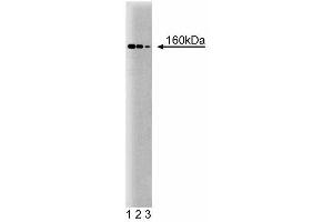 Western blot analysis of ROCK-I on mouse kidney lysate. (ROCK1 antibody  (AA 906-1012))