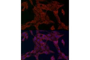 Immunofluorescence analysis of PC-12 cells using SLC27 Rabbit pAb (2847) at dilution of 1:100 (40x lens). (SLC27A1 antibody  (AA 347-646))