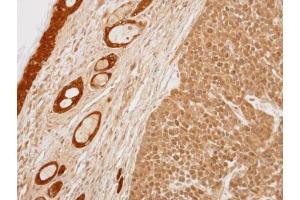 IHC-P Image Immunohistochemical analysis of paraffin-embedded 59T xenograft, using 14-3-3 sigma, antibody at 1:100 dilution. (14-3-3 sigma/SFN antibody  (C-Term))