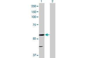 Western Blot analysis of EPHX2 expression in transfected 293T cell line by EPHX2 MaxPab polyclonal antibody. (EPHX2 antibody  (AA 1-555))