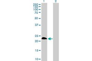 Lane 1: TWIST1 transfected lysate ( 21. (TWIST1 293T Cell Transient Overexpression Lysate(Denatured))