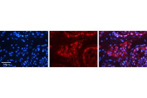 Rabbit Anti-HSPA4 Antibody   Formalin Fixed Paraffin Embedded Tissue: Human Testis Tissue Observed Staining: Cytoplasm in spermatogonia and Leydig cells Primary Antibody Concentration: 1:100 Other Working Concentrations: 1:600 Secondary Antibody: Donkey anti-Rabbit-Cy3 Secondary Antibody Concentration: 1:200 Magnification: 20X Exposure Time: 0.