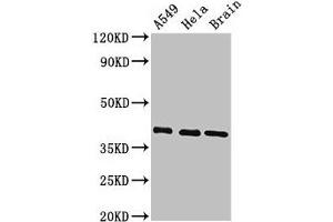 Western Blot Positive WB detected in: A549 whole cell lysate, Hela whole cell lysate, Mouse brain tissue All lanes: HLA-C antibody at 3. (HLA-C antibody  (AA 62-306))