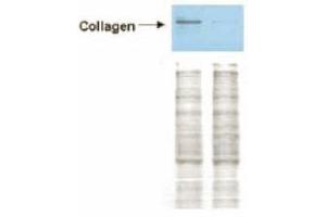 Western blot analysis is shown using ABIN116549, affinity purified anti-Collagen I antibody to detect expression of collagen I in Wistar rat hepatic stellate cell (HSC) in control -GFP transduced (left lane) and -PPARgamma transduced cell lysates (right lane). (Collagen Type I antibody)