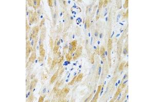 Immunohistochemistry of paraffin-embedded mouse heart using PHPT1 antibody. (PHPT1 antibody  (AA 1-125))
