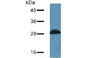 Detection of PRR7 / TRAP3 in murine brain lysate by Western blotting using the monoclonal antibody (PRR7 antibody  (C-Term, Intracellular))