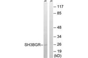 Western blot analysis of extracts from Jurkat cells, using SH3BGR Antibody. (SH3BGR antibody  (AA 81-130))