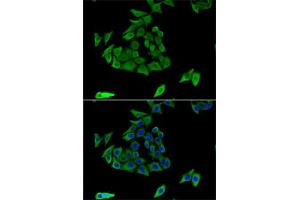 Immunofluorescence analysis of U2OS cells using TGM3 antibody (ABIN6132263, ABIN6149094, ABIN6149095 and ABIN6221560). (TGM3 antibody  (AA 1-180))