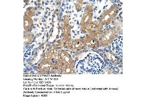 Rabbit Anti-CYP4A22 Antibody  Paraffin Embedded Tissue: Human Kidney Cellular Data: Epithelial cells of renal tubule Antibody Concentration: 4. (CYP4A22 antibody  (N-Term))