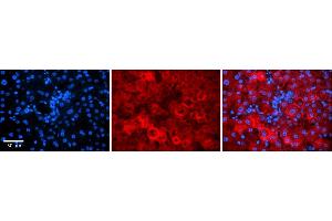 Immunohistochemistry (IHC) image for anti-Guanine Nucleotide Binding Protein (G Protein), beta Polypeptide 2-Like 1 (GNB2L1) (C-Term) antibody (ABIN2778966)