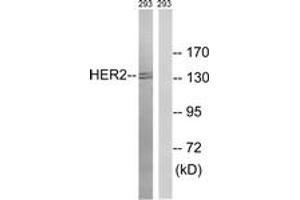 Western blot analysis of extracts from 293 cells, treated with Ca2+ 40nM 30', using HER2 (Ab-1112) Antibody. (ErbB2/Her2 antibody  (AA 1081-1130))
