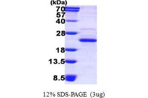 SDS-PAGE (SDS) image for DCTP Pyrophosphatase 1 (DCTPP1) (AA 1-170) protein (His tag) (ABIN667657)