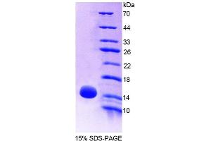 SDS-PAGE analysis of Mouse OT Protein. (OXT Protein)