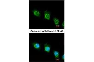 ICC/IF Image Immunofluorescence analysis of methanol-fixed HeLa, using USP47, antibody at 1:200 dilution. (USP47 antibody)