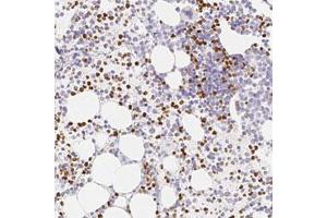 Immunohistochemical staining (Formalin-fixed paraffin-embedded sections) of human bone marrow with PADI4 polyclonal antibody  shows strong cytoplasmic and nuclear positivity in subset of hematopoietic cells.