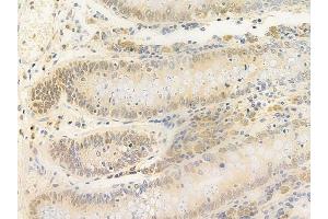 ABIN6258118 and ABIN6275066 at 1/100 staining human normal colon tissue by IHC-P.