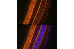 Immunofluorescence analysis of rat eye using V Rabbit mAb (ABIN7271313) at dilution of 1:100 (40x lens). (VAMP2 antibody)