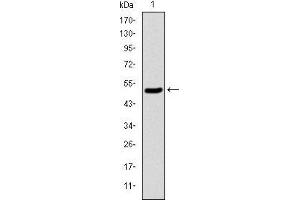 Western blot analysis using KID mAb against human KID (AA: 225-419) recombinant protein. (KIF22 antibody)