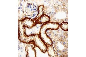 Immunohistochemistry (Paraffin-embedded Sections) (IHC (p)) image for anti-F-Box and Leucine-Rich Repeat Protein 17 (FBXL17) (AA 262-297), (C-Term), (Isoform 2) antibody (ABIN1944744)