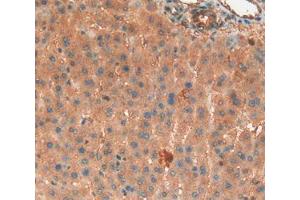 IHC-P analysis of Liver Tissue, with DAB staining.