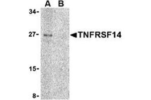 Western blot analysis of TNFRSF14 in Raji cell lysate with this product at 2 μg/ml in (A) the absence and (B) the presence of blocking peptide. (HVEM antibody  (C-Term))