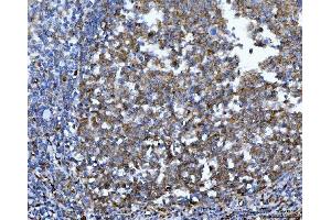 IHC analysis of YWHAE using anti-YWHAE antibody (ABIN7599165). (YWHAE antibody  (AA 1-255))