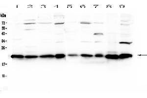 Western blot analysis of HP1 gamma using anti-HP1 gamma antibody . (CBX3 antibody  (AA 2-183))