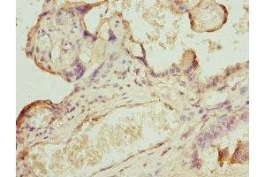 Immunohistochemistry of paraffin-embedded human placenta tissue using ABIN7146436 at dilution of 1:100 (CAMK1D antibody  (AA 1-180))