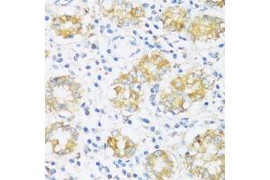 Immunohistochemistry of paraffin-embedded human stomach using BRSK1 antibody  at dilution of 1:100 (40x lens). (BRSK1 antibody  (AA 310-510))
