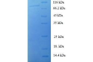 SDS-PAGE (SDS) image for Muscle, Skeletal, Receptor Tyrosine Kinase (MUSK) (AA 24-495), (Extracellular) protein (GST tag) (ABIN5709979) (MUSK Protein (AA 24-495, Extracellular) (GST tag))