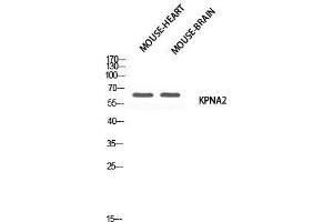 Western Blot (WB) analysis of Mouse Heart Mouse Brain using KPNA2 antibody. (KPNA2 antibody)
