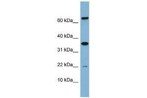 RWDD1 antibody used at 1 ug/ml to detect target protein. (RWDD1 antibody  (Middle Region))