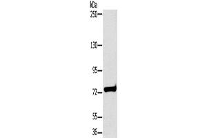 Western Blotting (WB) image for anti-Hydroxysteroid (17-Beta) Dehydrogenase 4 (HSD17B4) antibody (ABIN2430255) (HSD17B4 antibody)