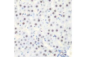Immunohistochemistry of paraffin-embedded rat liver using CASP9 antibody at dilution of 1:100 (40x lens). (Caspase 9 antibody)