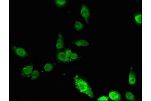 Immunofluorescent analysis of Hela cells using ABIN7156257 at dilution of 1:100 and Alexa Fluor 488-congugated AffiniPure Goat Anti-Rabbit IgG(H+L) (ING5 antibody  (AA 32-207))