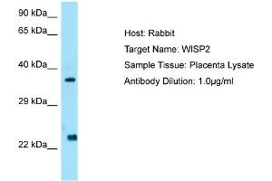 Host: Rabbit  Target Name: WISP2  Antibody Dilution: 1. (WISP2 antibody  (C-Term))
