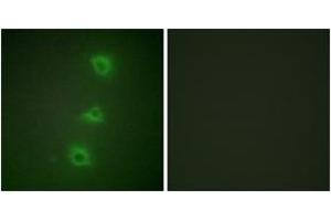 Immunofluorescence analysis of HuvEc cells, using B-RAF Antibody.