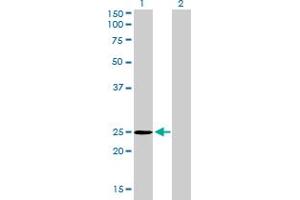 Western Blot analysis of THAP1 expression in transfected 293T cell line by THAP1 monoclonal antibody (M01), clone 2C1-2F2. (THAP1 antibody  (AA 1-213))