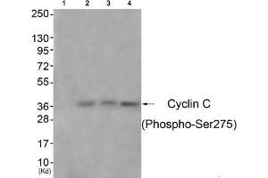 Western blot analysis of extracts from 3T3 cells (Lane 2), A549 cells (Lane 3) and Hela cells (Lane 4), using Cyclin C (Phospho-Ser275) Antibody. (Cyclin C antibody  (pSer275))