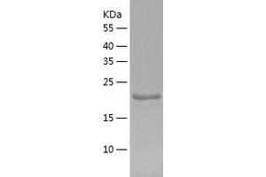 Western Blotting (WB) image for SSU72 RNA Polymerase II CTD Phosphatase Homolog (SSU72) (AA 1-194) protein (His tag) (ABIN7125202) (SSU72 Protein (AA 1-194) (His tag))