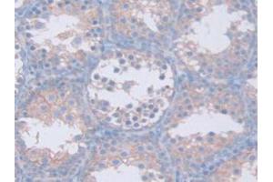 IHC-P analysis of Mouse Testis Tissue, with DAB staining. (GAMT antibody  (AA 2-236))