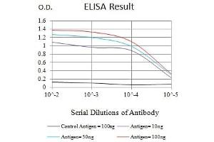 Black line: Control Antigen (100 ng),Purple line: Antigen (10 ng), Blue line: Antigen (50 ng), Red line:Antigen (100 ng)