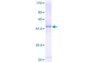 SERPINB5 Protein (AA 1-231) (GST tag)